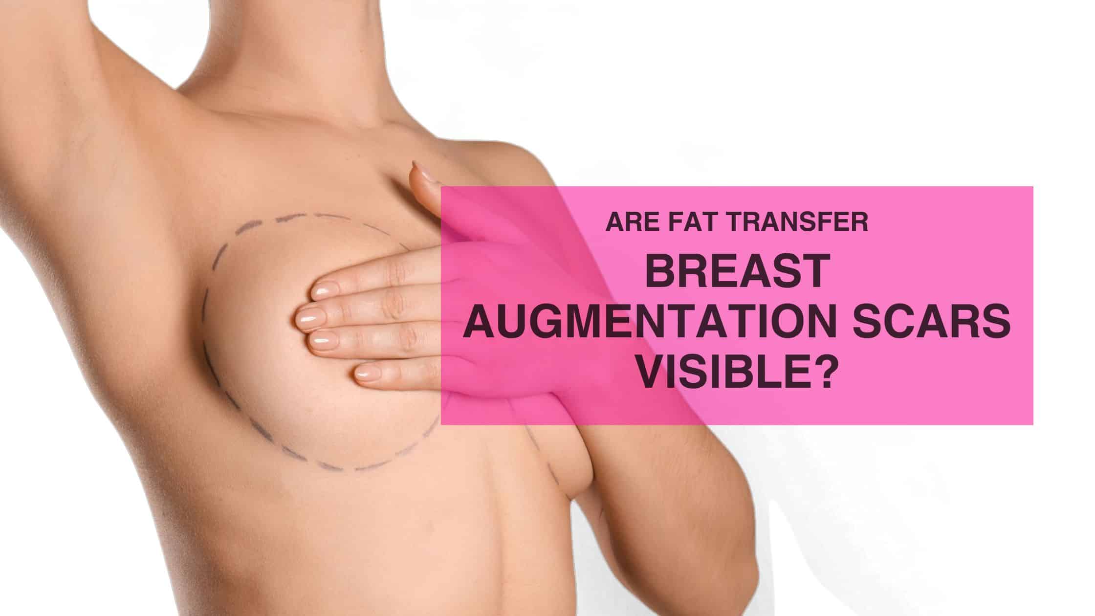 Are Fat Transfer Breast Augmentation Scars Visible