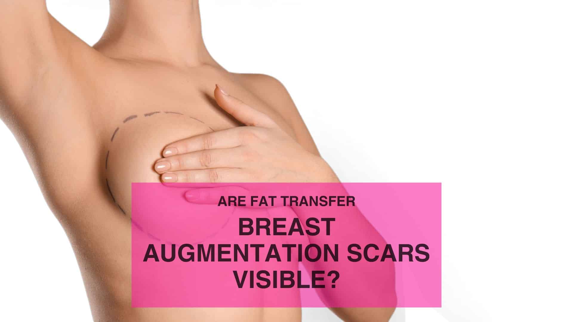 Are Fat Transfer Breast Augmentation Scars Visible