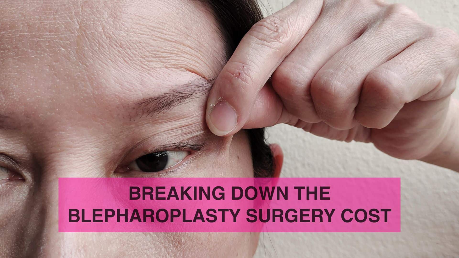 Breaking Down the Blepharoplasty Surgery Cost