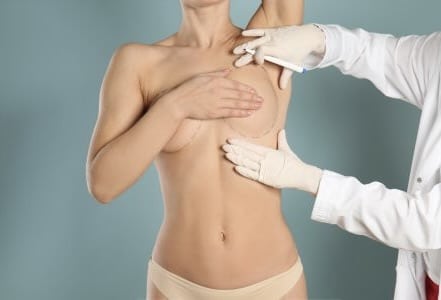 Breast Implant Incision Infection