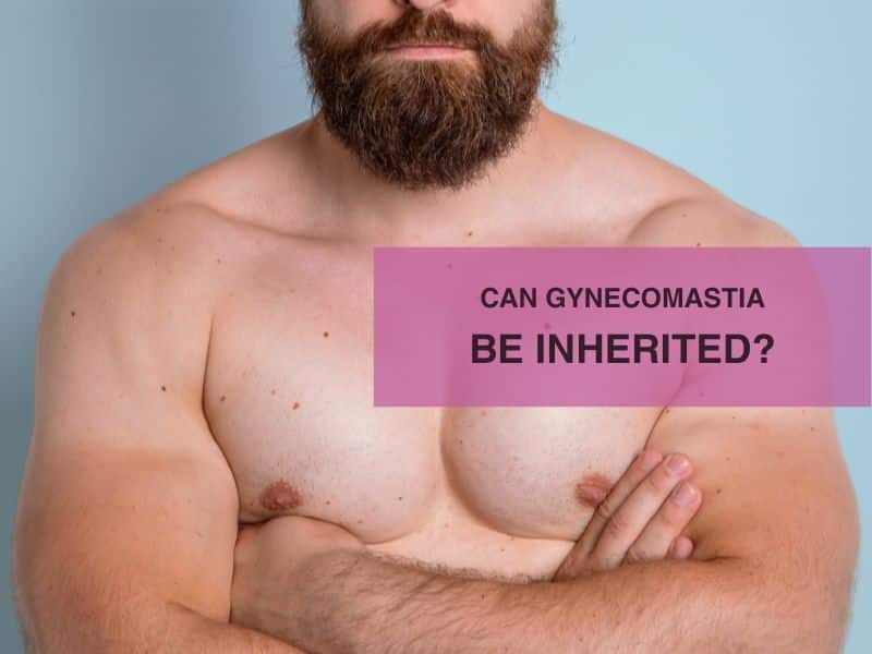 Can gynecomastia be inherited