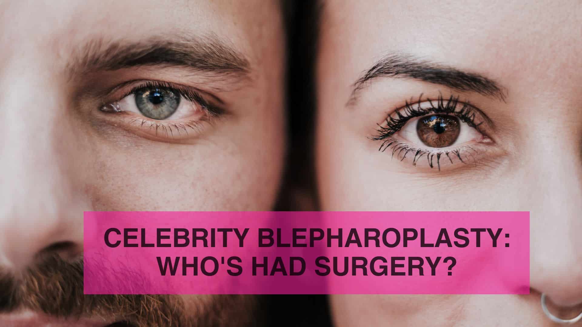 Celebrity Blepharoplasty Who's Had Surgery