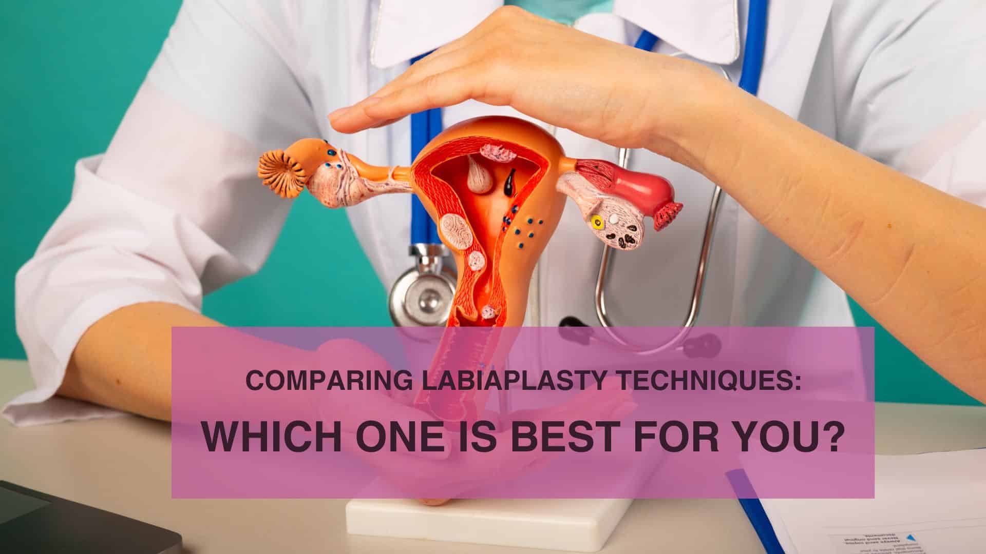 Comparing Labiaplasty Techniques Which One Is Best for You