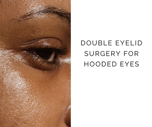 Double Eyelid Surgery for Hooded Eyes