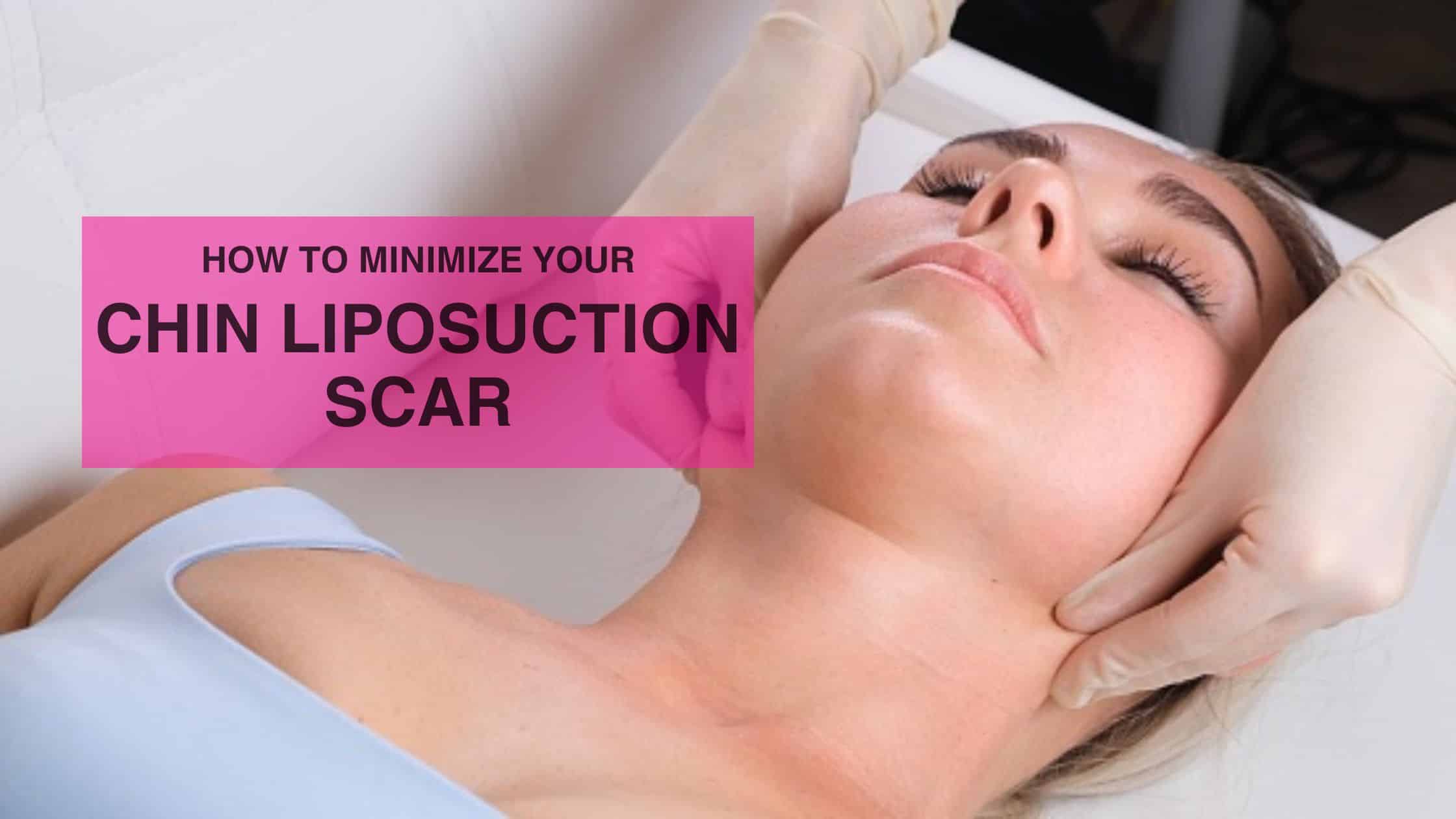 How to Minimize Your Chin Liposuction Scar