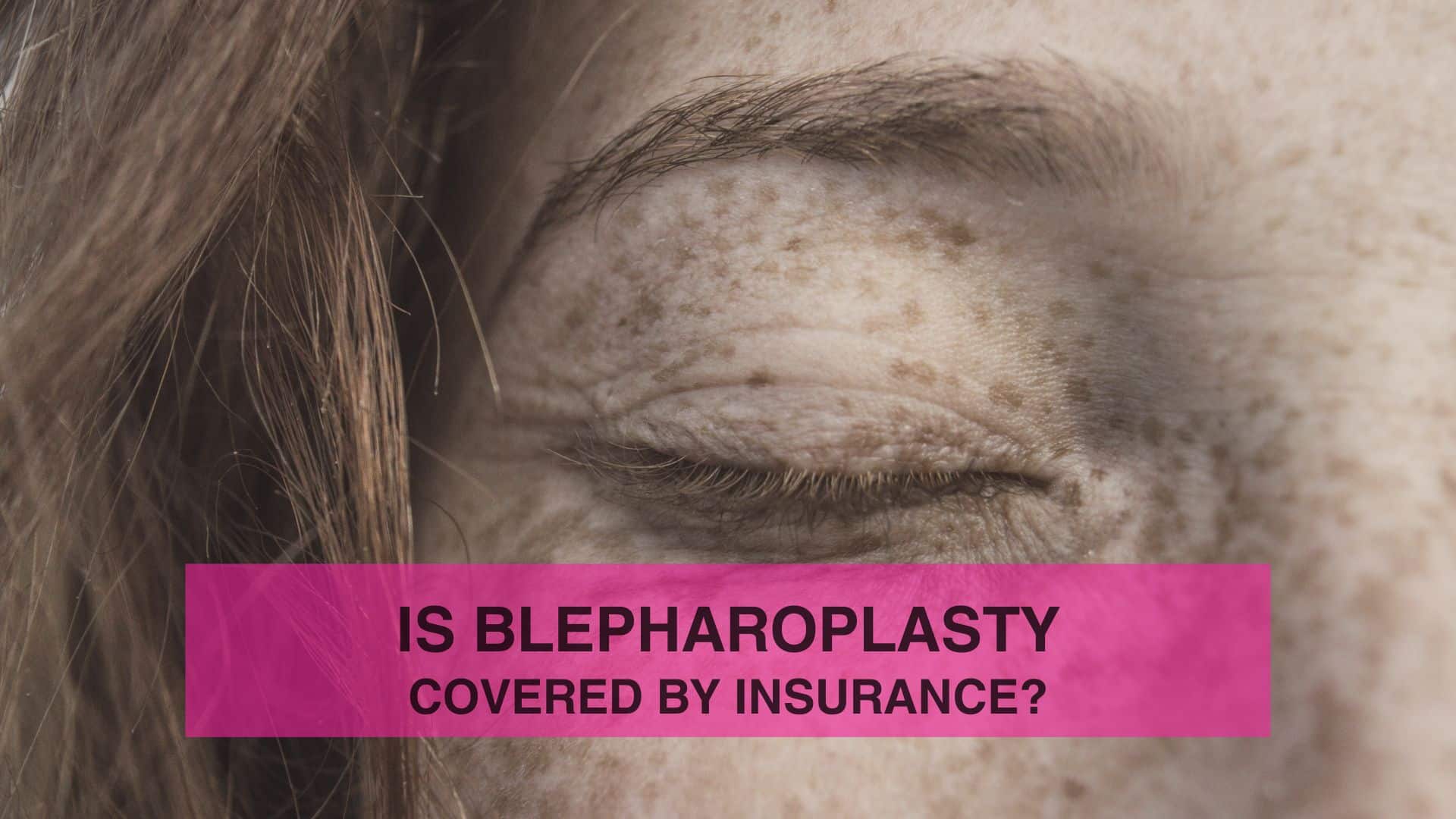 Is Blepharoplasty Covered by Insurance