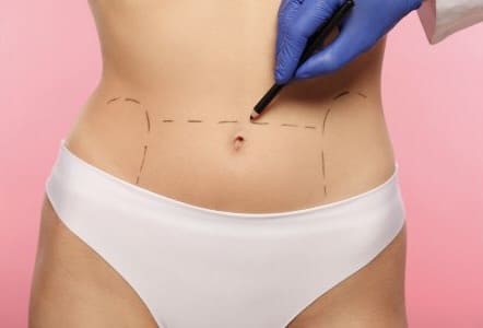 Plastic Surgery Types of Procedures