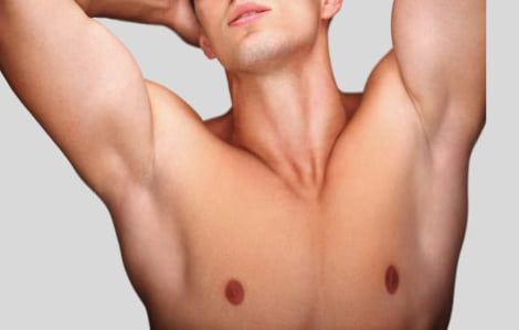 Recovery time after gynecomastia surgery