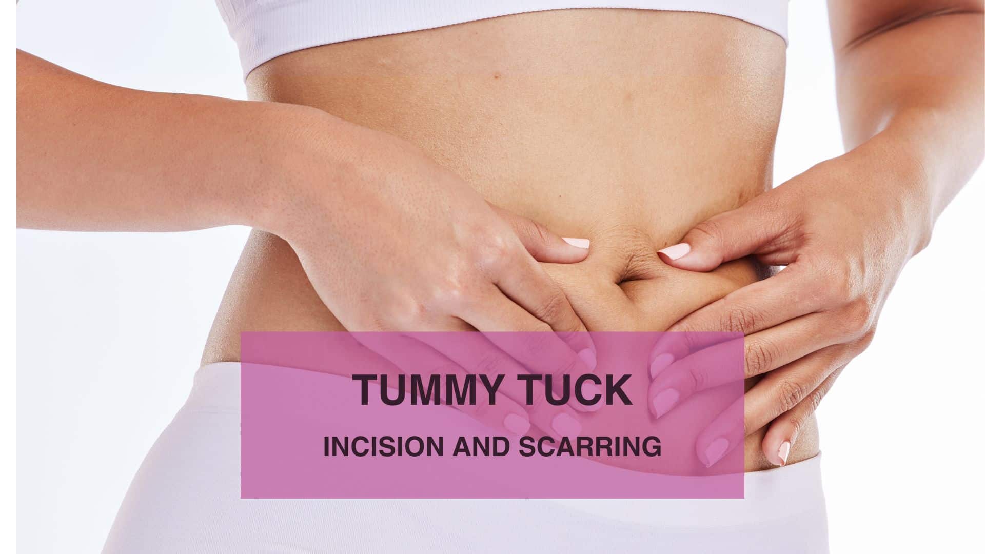 Tummy Tuck Incision and Scarring