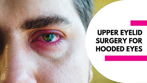 Upper Eyelid Surgery for Hooded Eyes