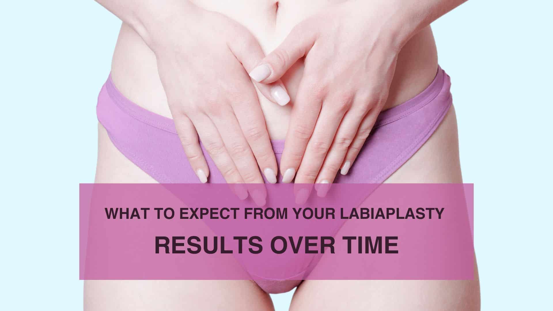 What to Expect from Your Labiaplasty Results Over Time