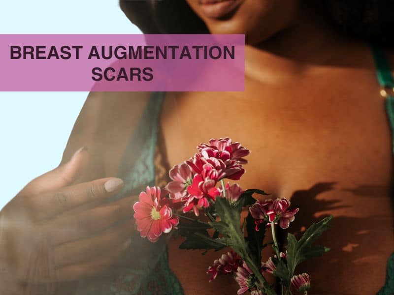 before and after fat transfer breast augmentation scars