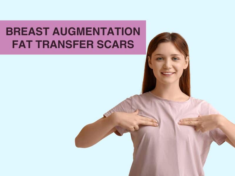 breast augmentation fat transfer scars