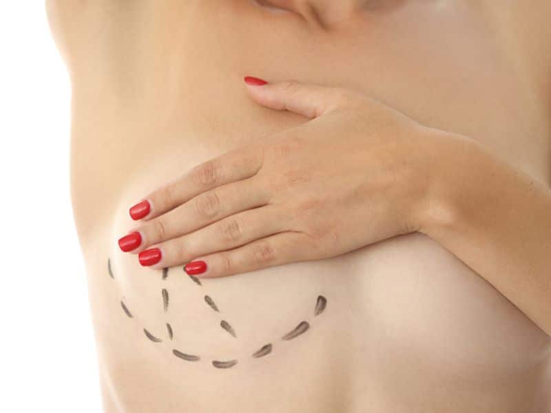 different types of breast lifts