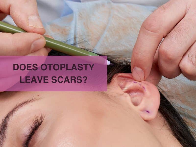 does otoplasty leave scars