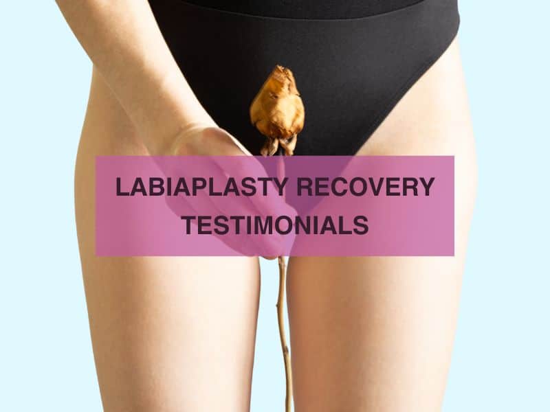 labiaplasty recovery testimonials