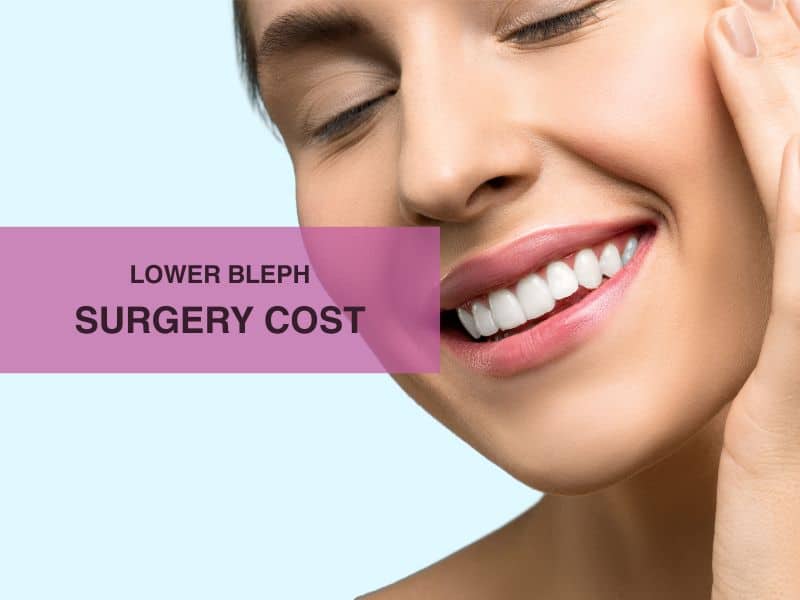 lower bleph surgery cost