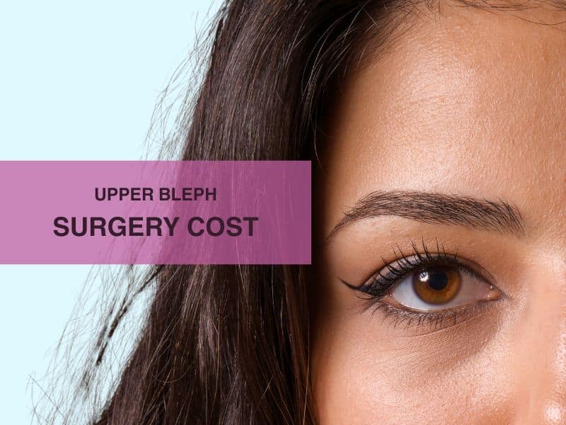 upper bleph surgery cost